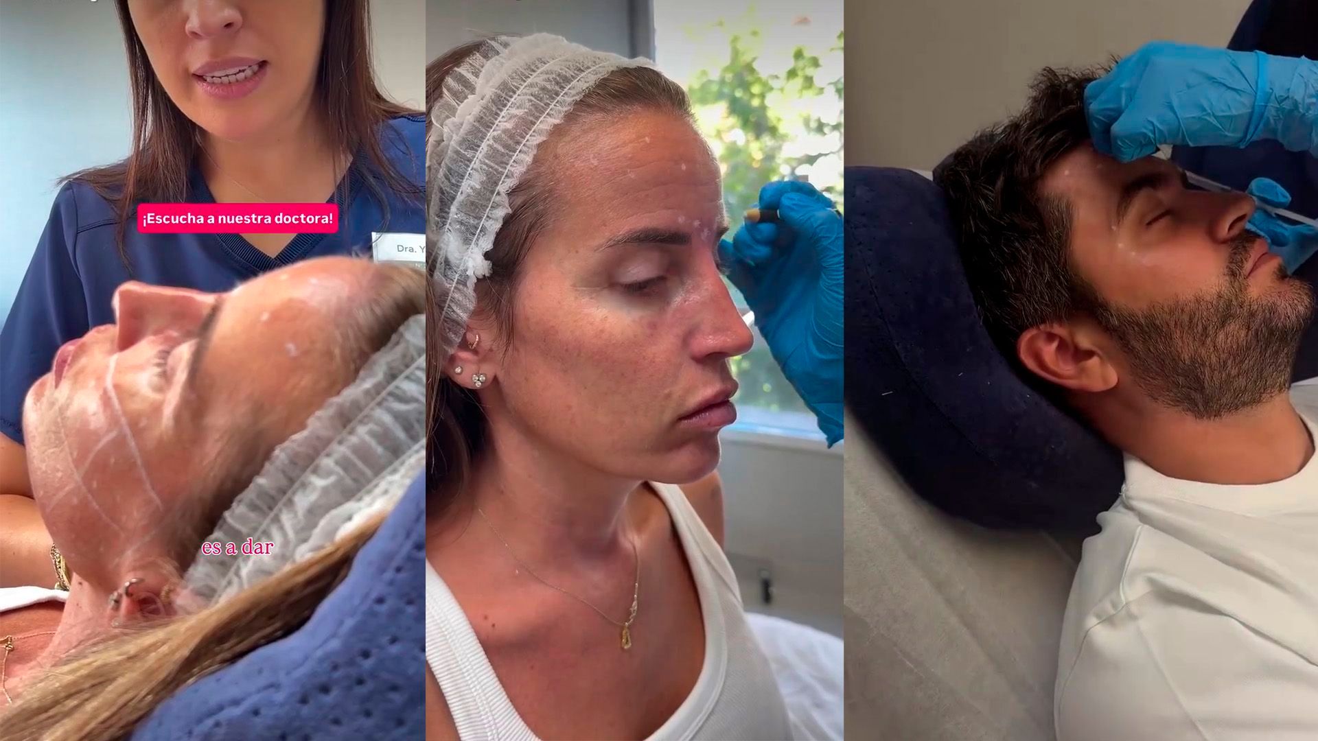 Marta y Rodri se ponen botox para eliminar las líneas de expresión