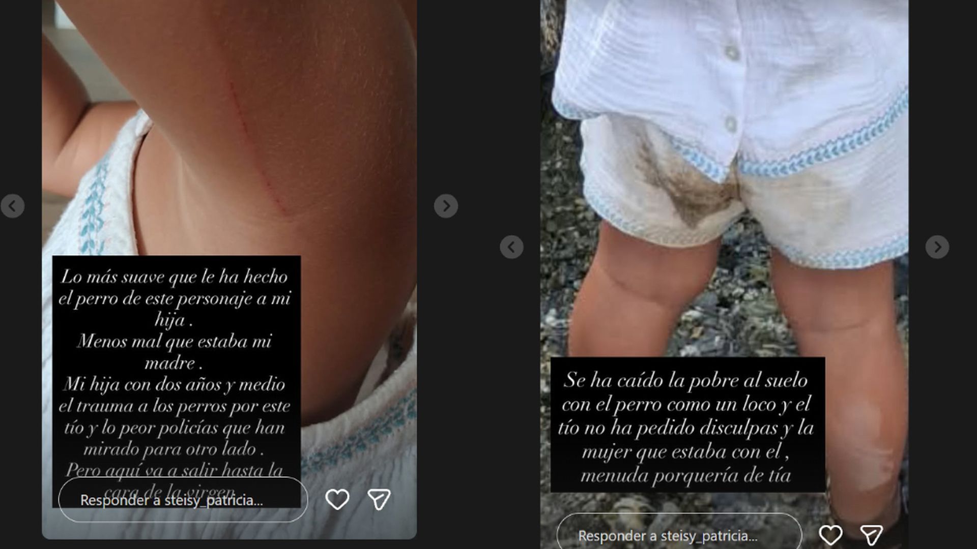 Las lesiones de la hija de Steisy