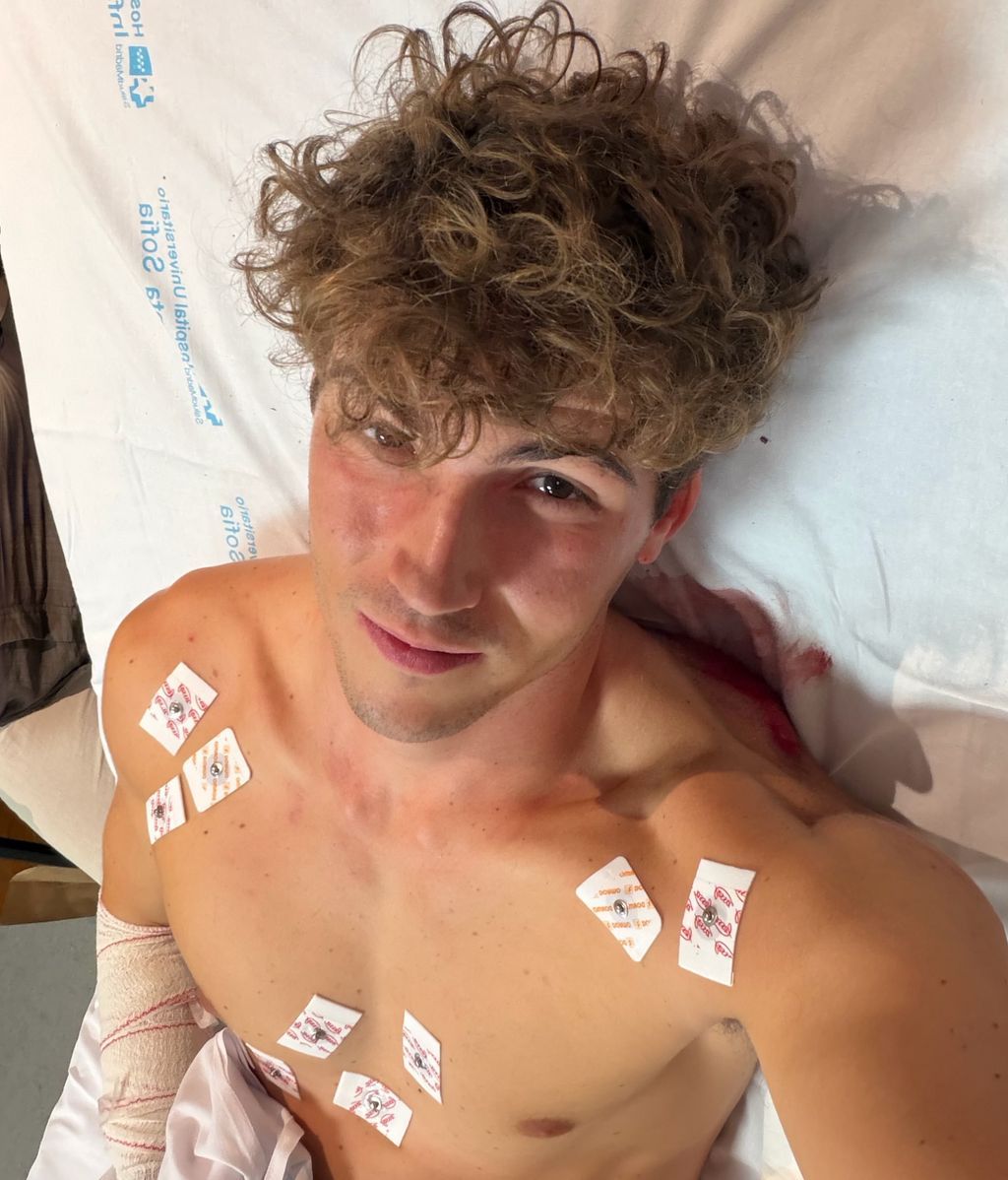 Javier Gallardo, tras el accidente de moto en Madrid