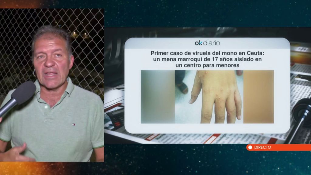 El presidente del Colegio de Médicos de Ceuta confirma el primer caso de viruela del mono: “Nos los han confirmado”