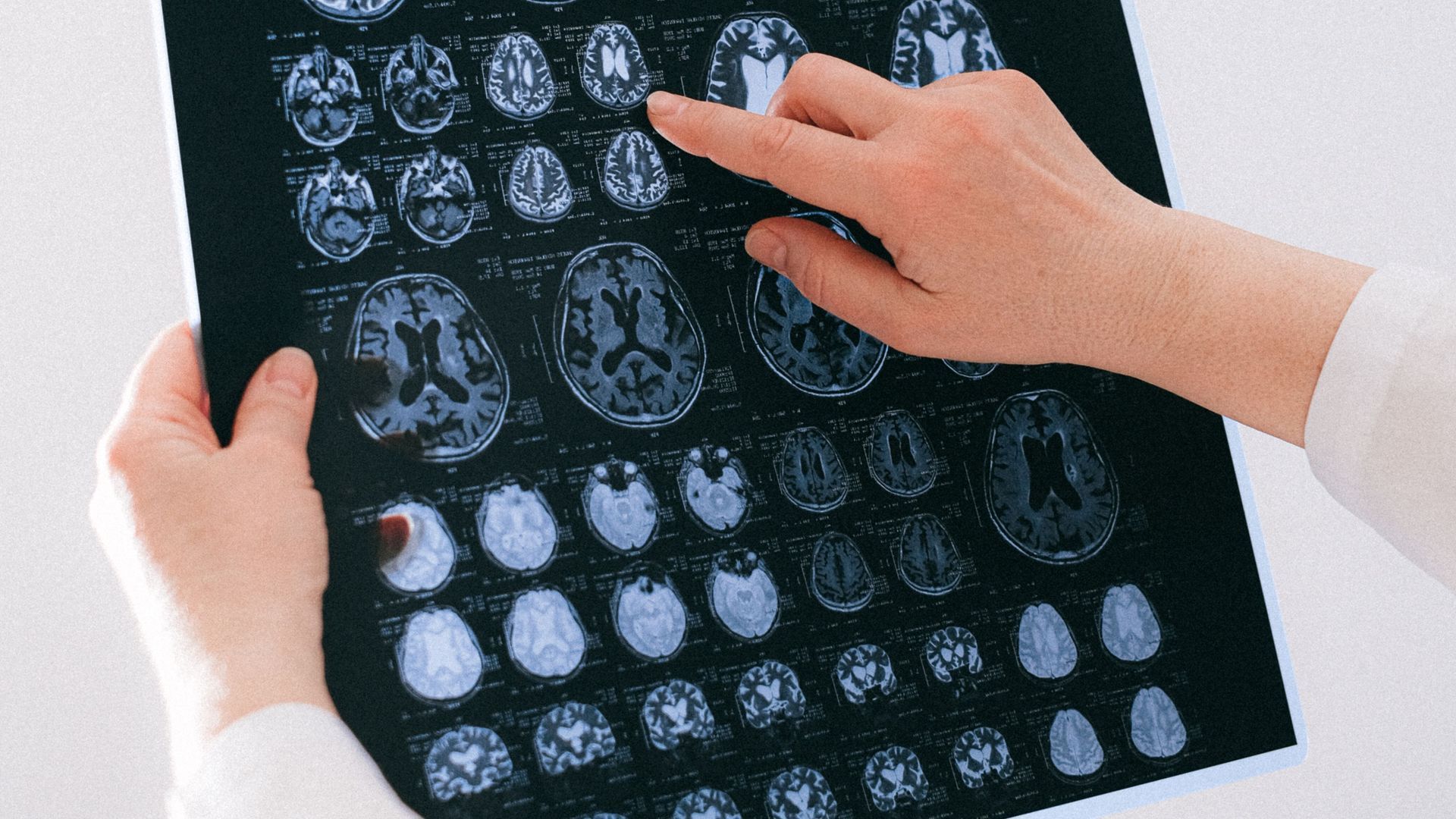 Una radiografía de un cerebro Una radiografía de un cerebro