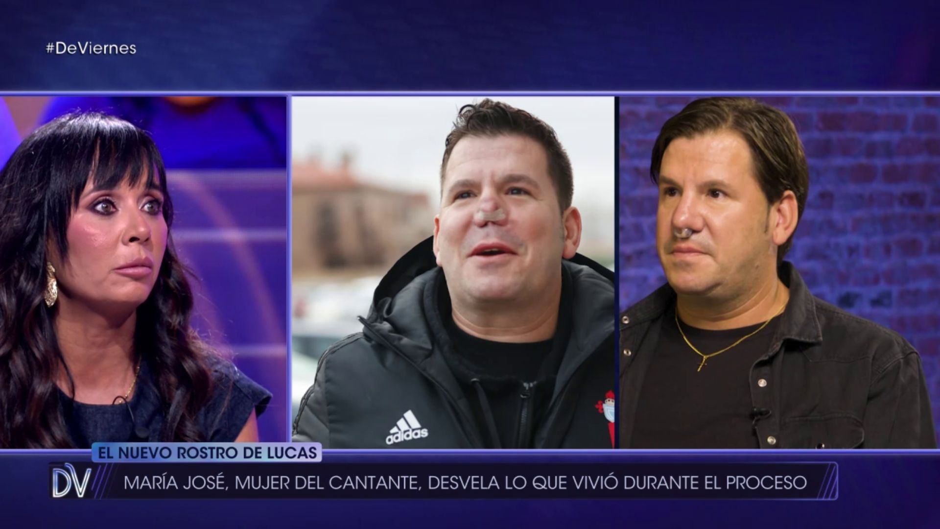 La mujer de Lucas González cuenta cómo vivió la operación de nariz: "Estaba muy nerviosa"