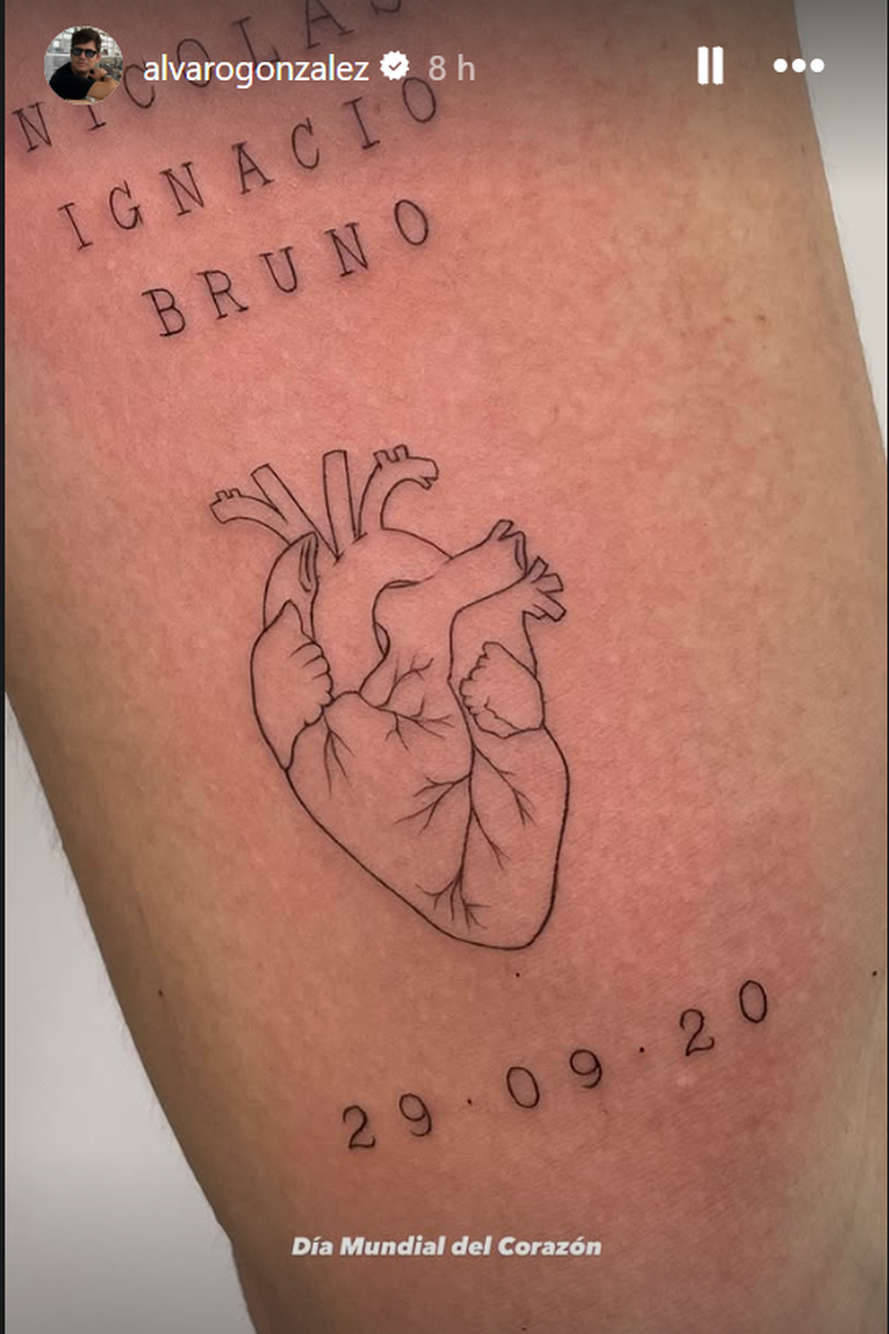 El tatuaje de Álvaro González en honor a su operación de corazón