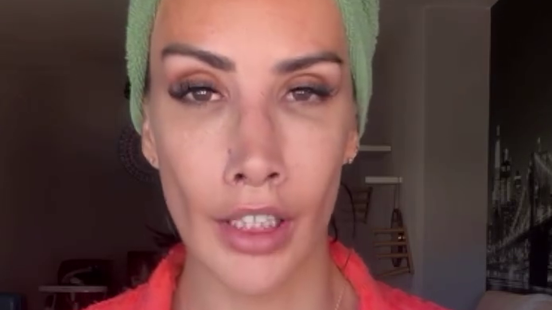 Fani Carbajo responde a las críticas recibidas tras realizarse un ‘lip lift’ Fani Carbajo responde a las críticas recibidas tras realizarse un ‘lip lift’