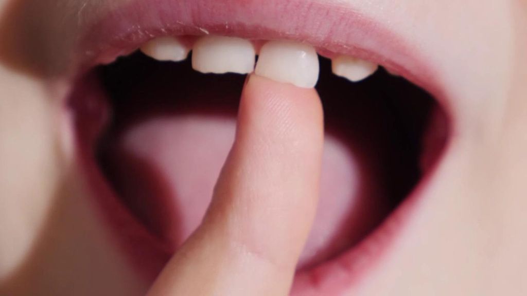 Los dientes de leche, esperanza contra enfermedades neurodegenerativas: sus células pueden transformarse en neuronas