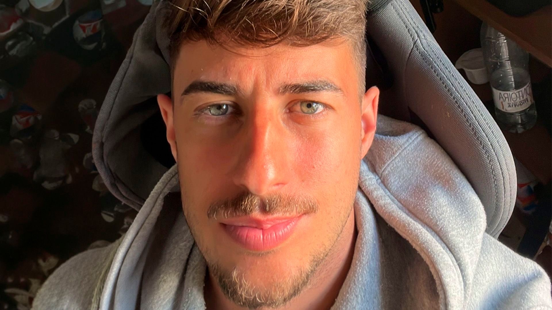 Borja Silva enseña el impactante resultado de su rinoplastia