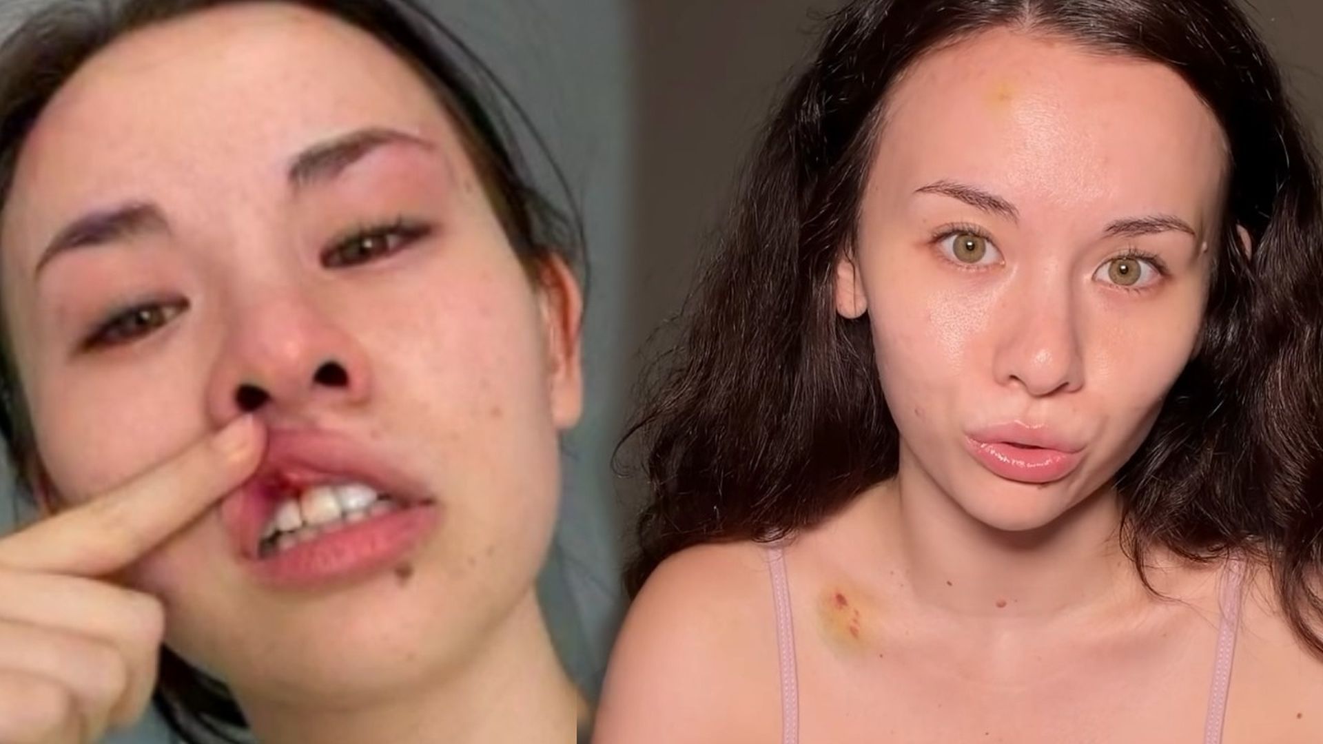 La influencer María Reus Huang es agredida por dos seguidoras en plena calle: "Noté un golpe en la nuca que me tiró al suelo" La influencer María Reus Huang es agredida por dos seguidoras en plena calle: "Noté un golpe en la nuca que me tiró al suelo"