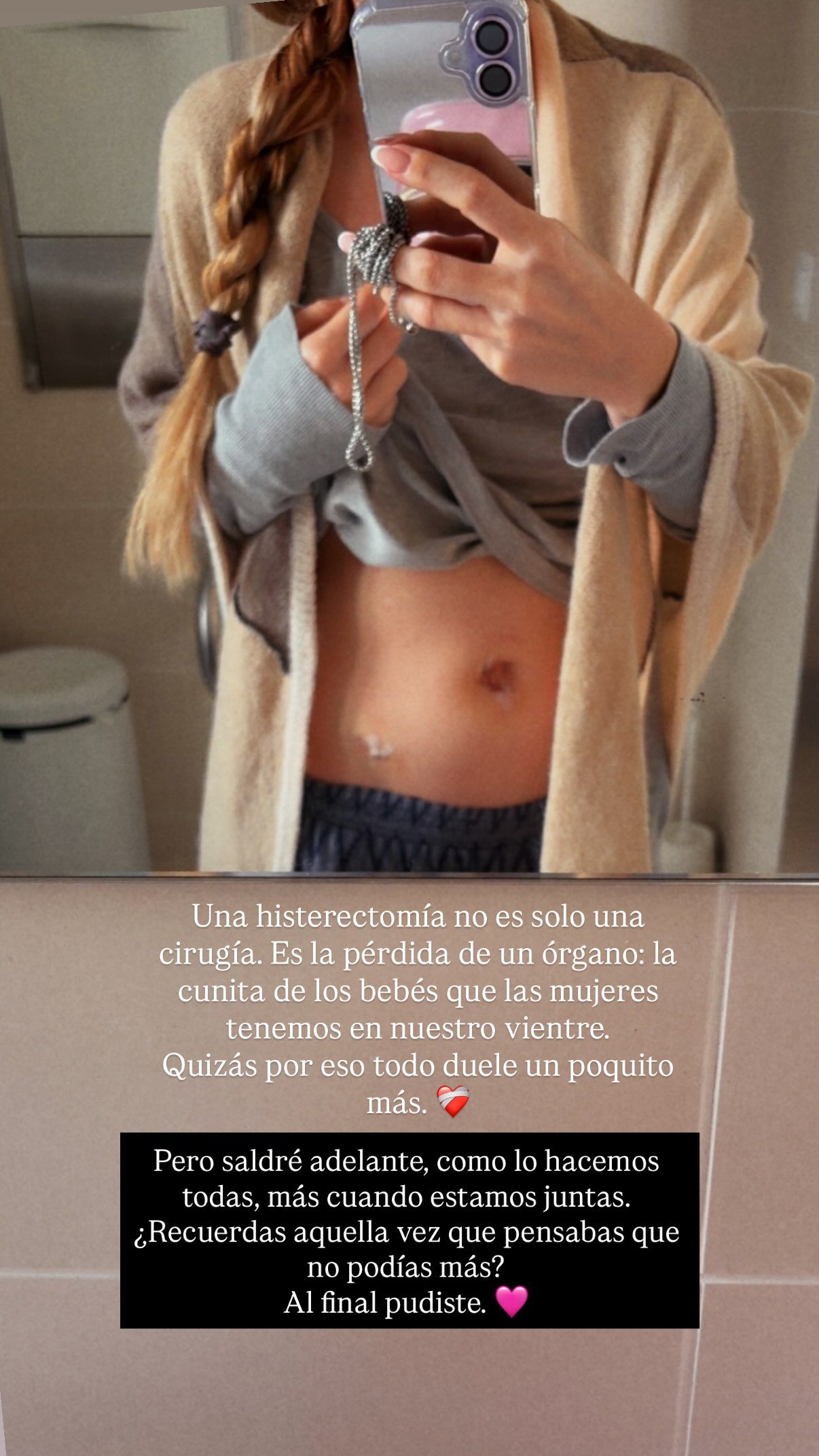 La Vecina Rubia muestra la cicatriz de su histerectomía