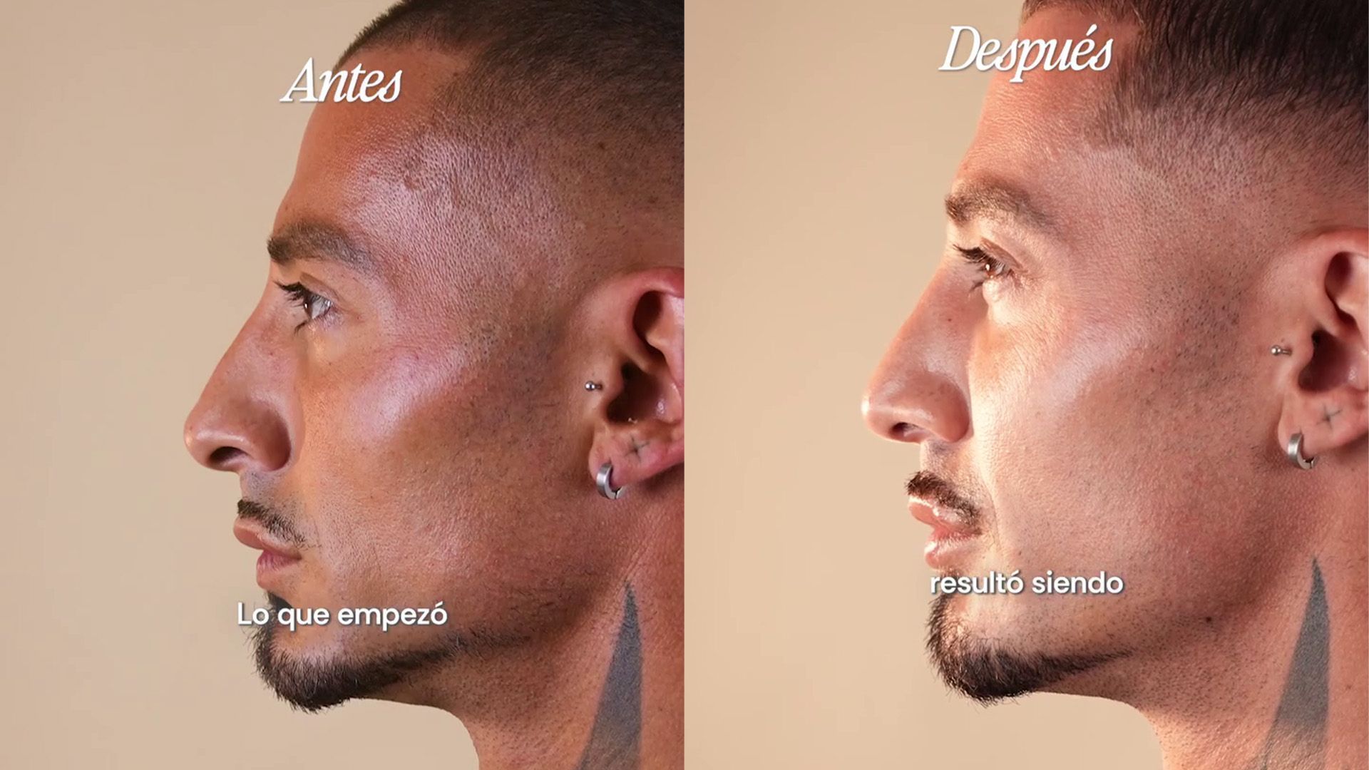 El antes y el después de la operación de Jose