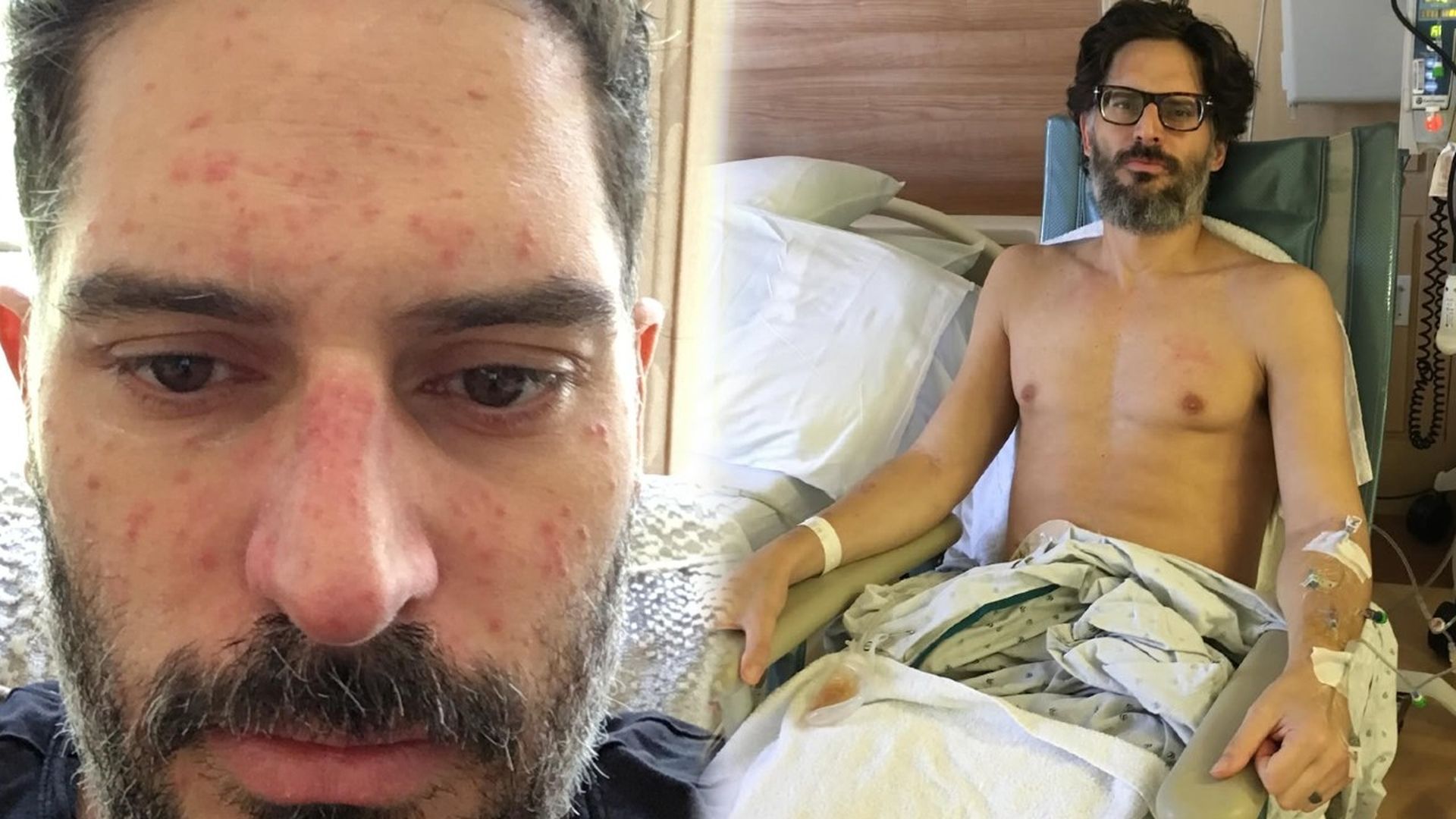 Joe Manganiello, actor de 'One Piece', publica unas imágenes después de que le extirpasen el intestino: "Perdí 27 kilos" Joe Manganiello, actor de 'One Piece', publica unas imágenes después de que le extirpasen el intestino: "Perdí 27 kilos"