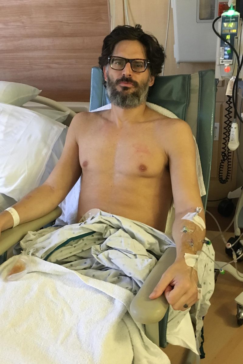 Joe Manganiello muestra la extirpación de su intestino grueso y que perdió 27 kilos en dos semanas