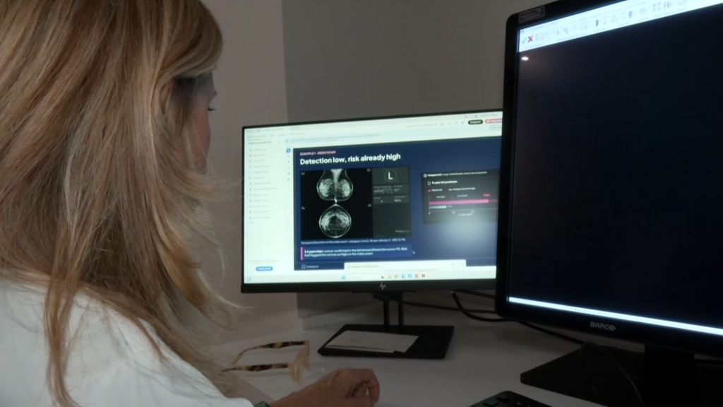 El Hospital Reina Sofía de Córdoba desarrolla un programa con IA que predice el riesgo de cáncer de mama con hasta cinco años de antelación