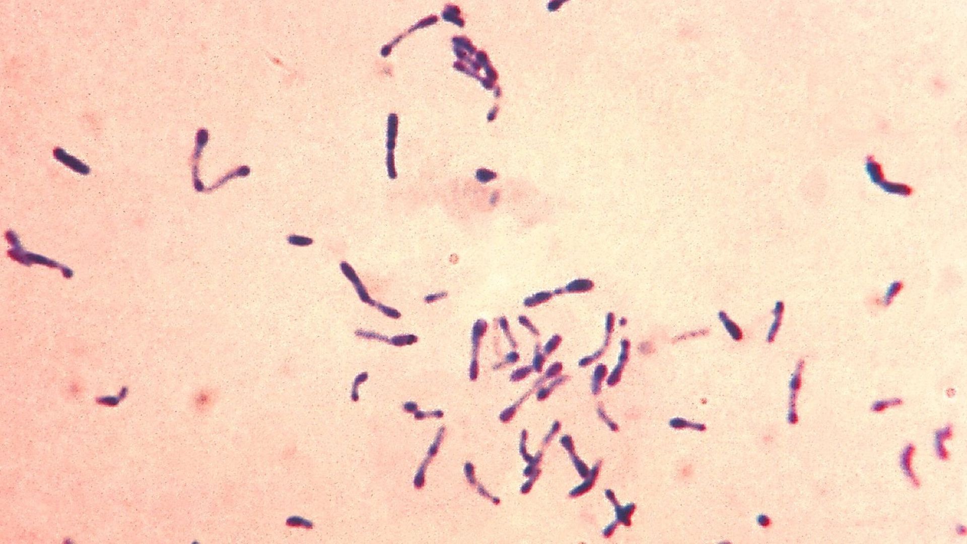 Difteria Difteria