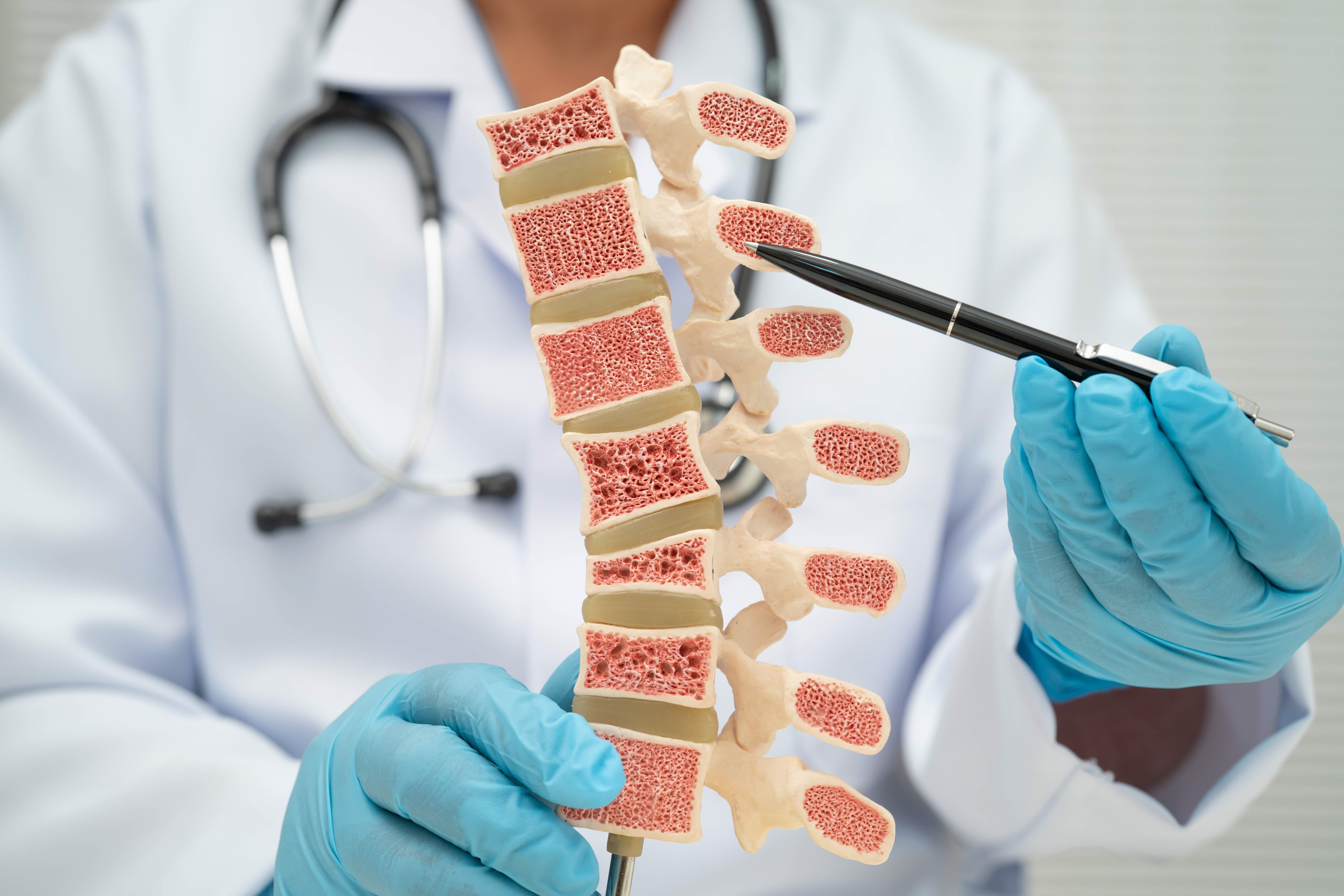 Osteoporosis