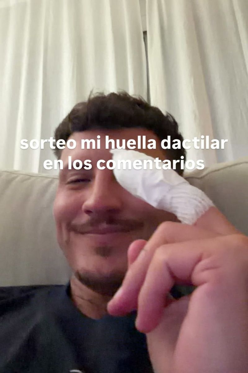 Jonan Wiergo bromea sobre el accidente que ha sufrido al perder parte de su dedo