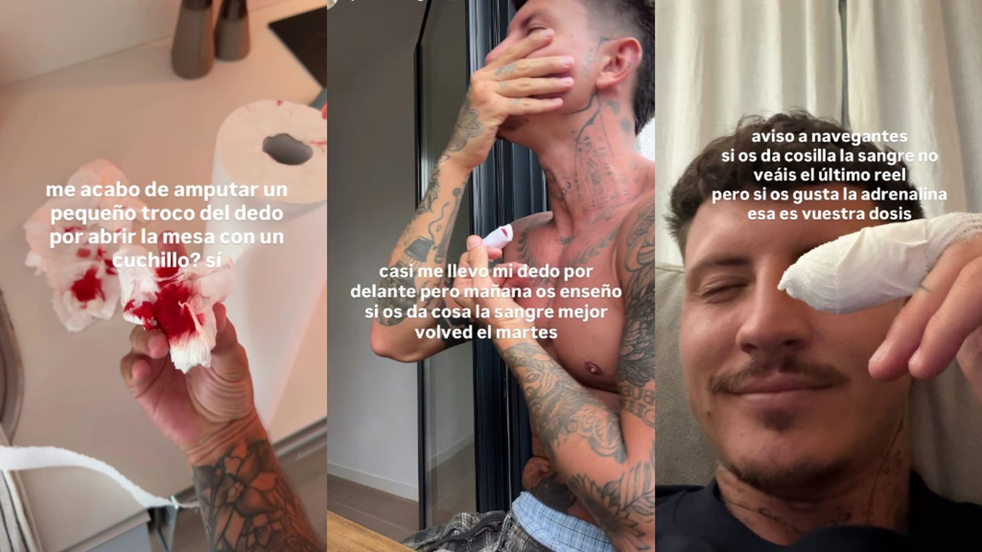 Jonan Wiergo sufre un accidente doméstico: "Me he amputado un trozo del dedo, pero tengo el pedacito"