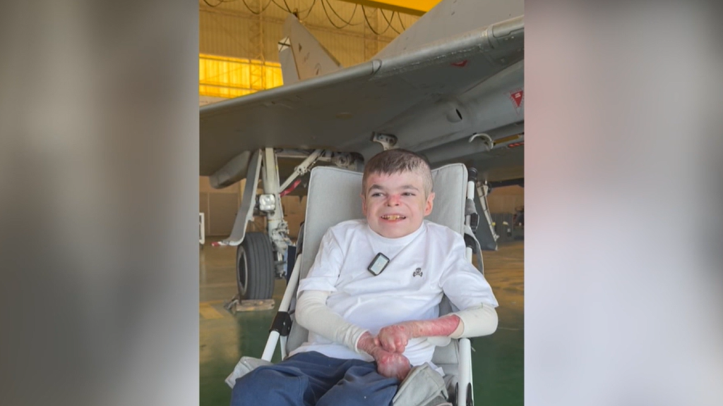 La emoción de Leo, el niño con piel de mariposa, al recibir un regalo del Ejército del Aire en Sevilla: "Me la voy a poner para el instituto"