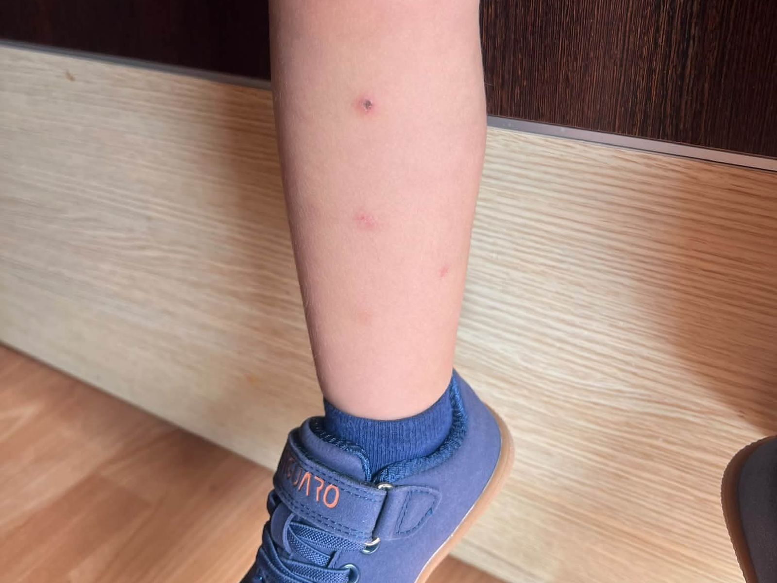 Piden una inspección sanitaria urgente en un colegio de Granada por las continuas picaduras de insectos a los escolares