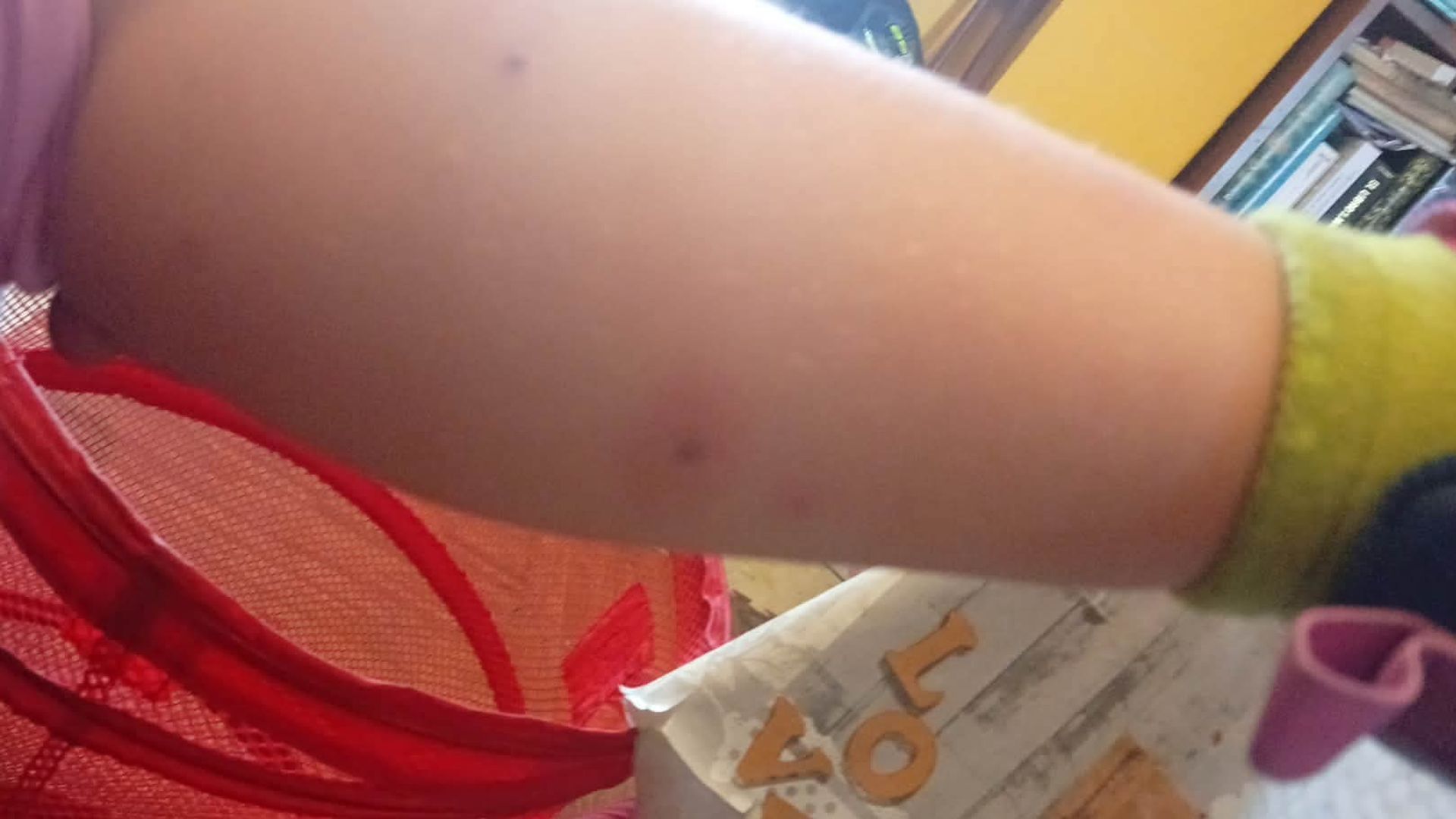 Piden una inspección sanitaria urgente en un colegio de Granada por las continuas picaduras de insectos a los escolares