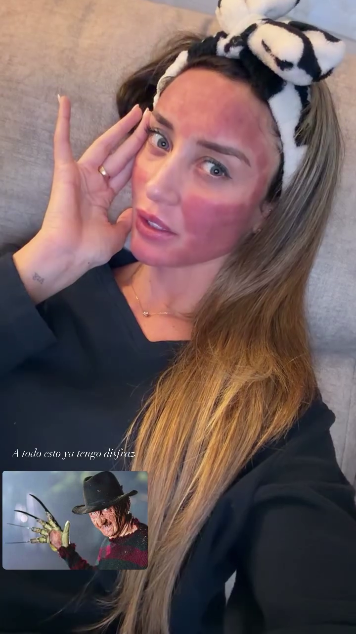 La cara de Yuli tras realizarse el láser