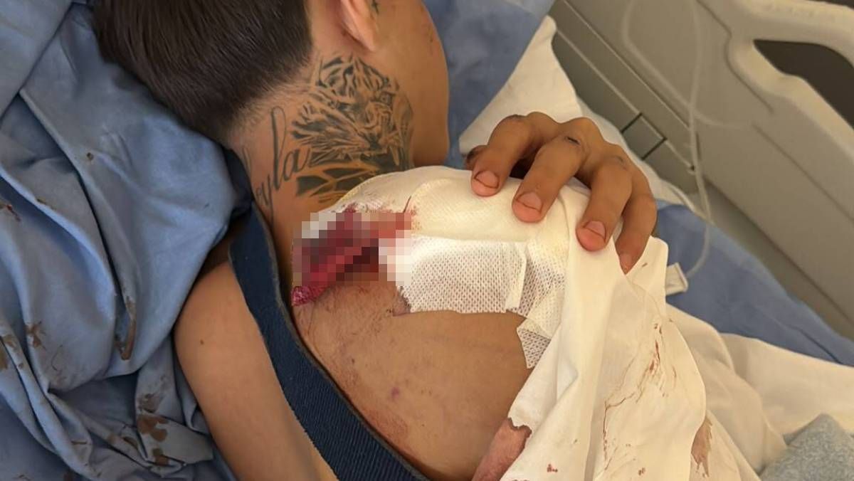 Piden ayuda para identificar al conductor que arrolló a Samuel en Málaga: le arrastró 56 metros y se dio a la fuga dejándolo en una cuneta