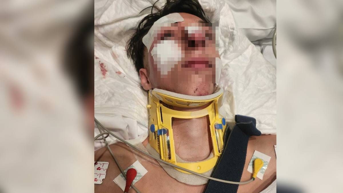 Piden ayuda para identificar al conductor que arrolló a Samuel en Málaga: le arrastró 56 metros y se dio a la fuga dejándolo en una cuneta