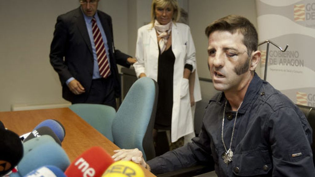 El torero Juan José Padilla sale del hospital